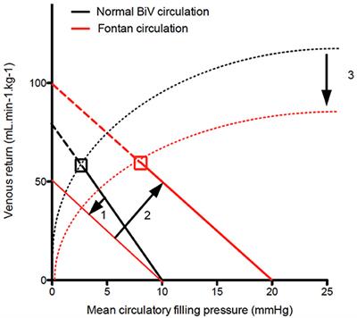 Late Fontan Circulatory Failure. What Drives Systemic Venous Congestion and Low Cardiac Output in Adult Fontan Patients?